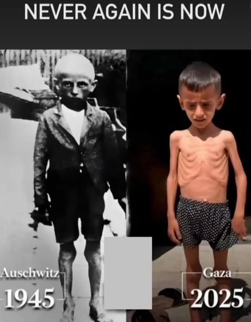 The image is a side-by-side comparison of two photographs, with a text overlay at the top that reads "NEVER AGAIN IS NOW." On the left, there is a black and white photograph of a young boy from Auschwitz in 1945. The boy is wearing a suit jacket and shorts, and his legs are visibly emaciated. On the right, there is a color photograph of a young boy from Gaza in 2025. The boy is shirtless, revealing severe malnutrition with prominent ribs and a gaunt appearance. He is wearing polka-dotted shorts and is standing in front of a dark background. The text "Auschwitz 1945" is overlaid on the left image, and "Gaza 2025" is overlaid on the right image. The juxtaposition of these images is meant to draw a parallel between the historical and contemporary contexts of suffering.