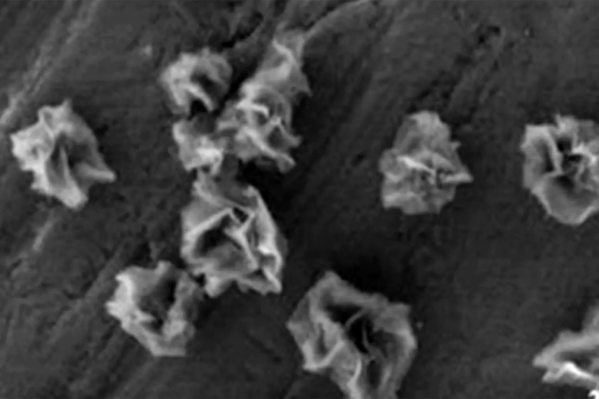 Un team di ricercatori texani ha sviluppato nanofiori metallici che riparano i mitocondri cerebrali danneggiati. I test mostrano una riduzione del 99% dello stress ossidativo in 24 ore e un aumento della durata di vita nei modelli animali. Queste particelle microscopiche a forma di fiore potrebbero aprire una nuova strada per curare alzheimer e parkinson alla radice, non più solo gestendo i sintomi.