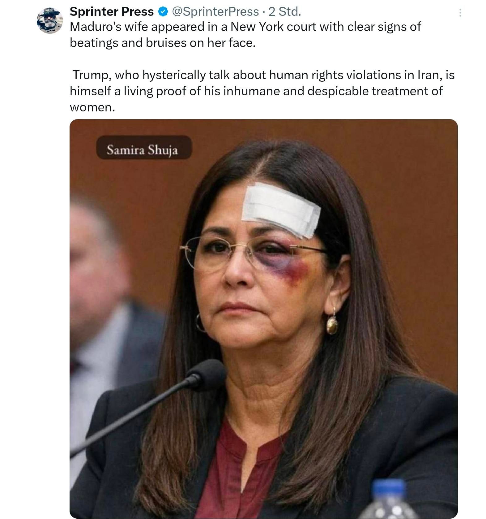 Sprinter press, maduros wife appeared in new York court US with clesr signs of beatings and bruises on her face...