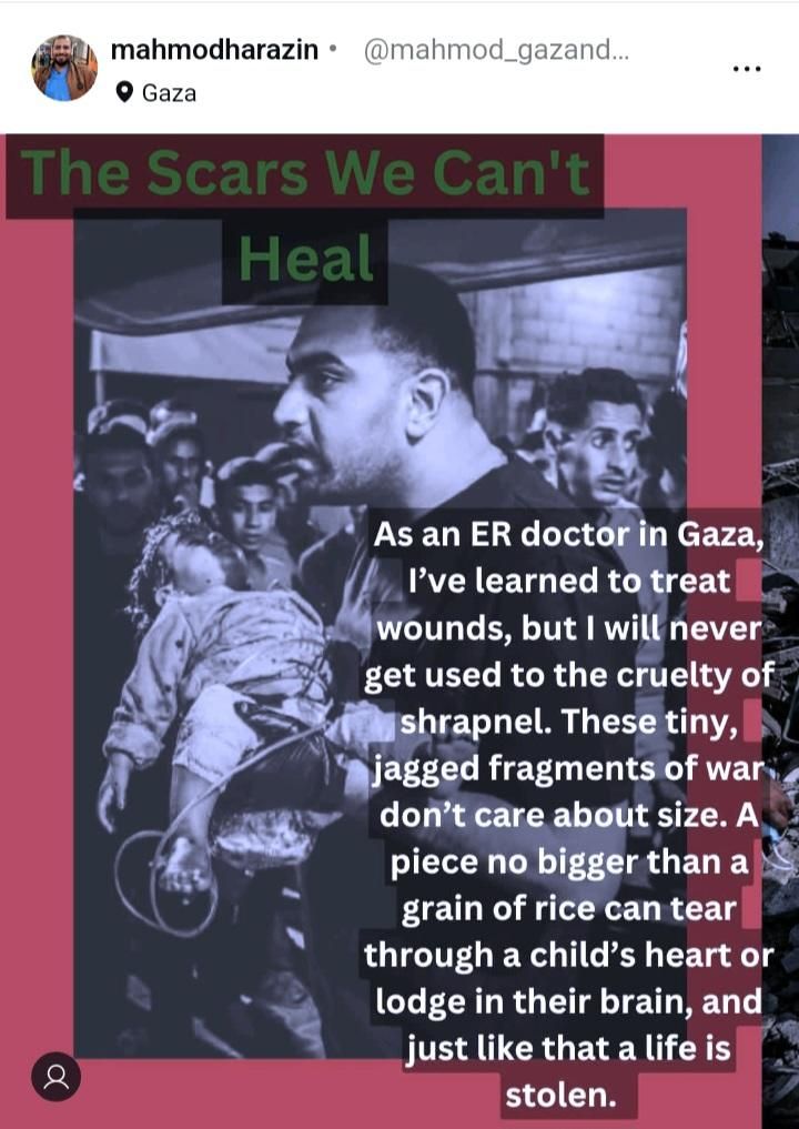 A man holds a baby in his arms. The baby is wounded and presumably bleeding. He is a doctor in Gaza. He looks like running with the baby towards the hospital. 
A text by the doctor:"As an ER doctor in Gaza I've learned to treat wounds, but I will never get used to the cruelty of shrapnel. These tiny jagged fragments of war don't care about size. A piece no bigger than a grain of rice can tear  through a child's heart or lodge in their brain and just like that a life is stolen."