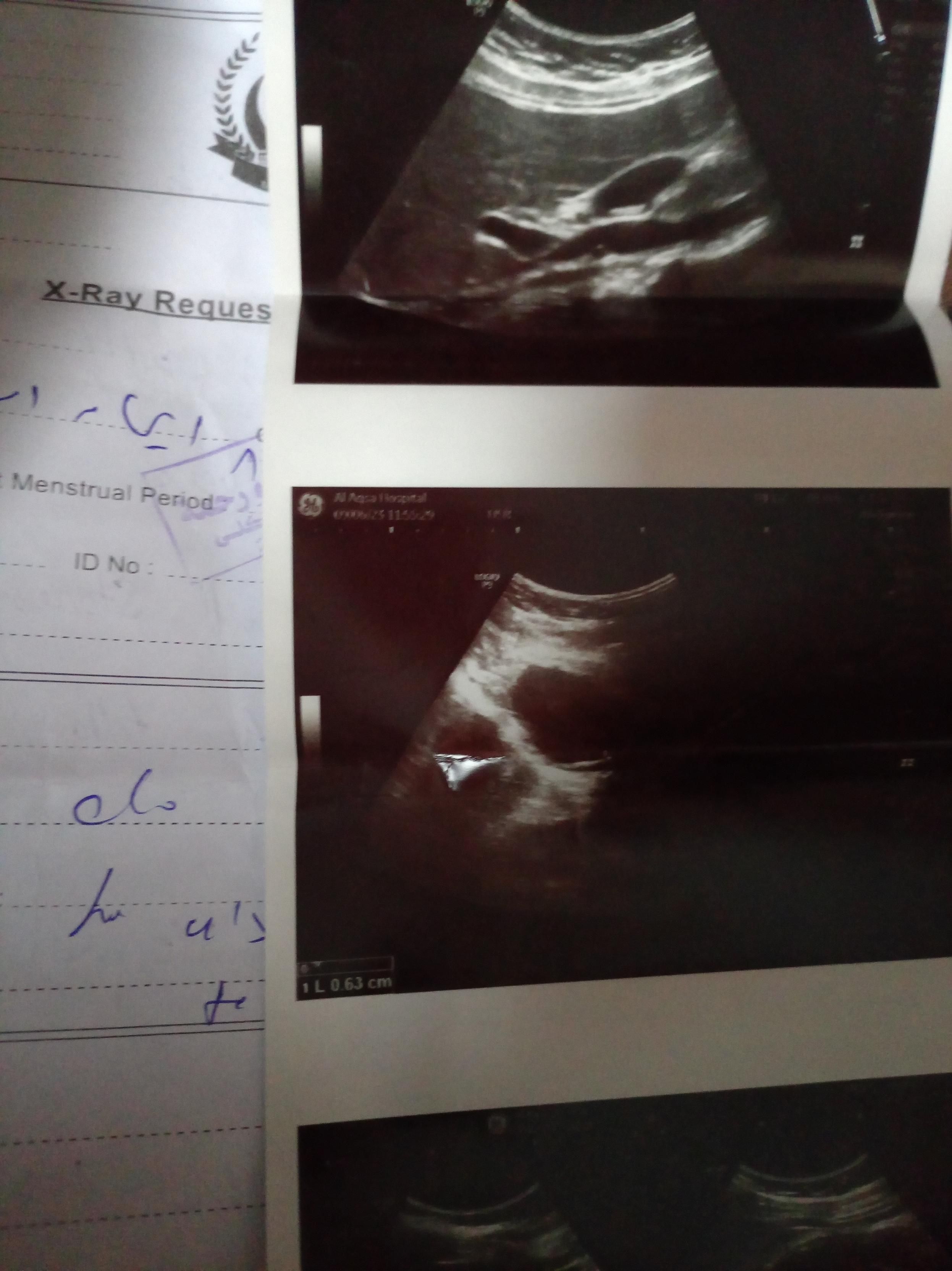 Hello my friends 
Thank you to everyone who asked about me I had a health problem that put me in the hospital 
I still need your support and donations more than ever 
I need $350 for other tests and some medications, please answer my call.