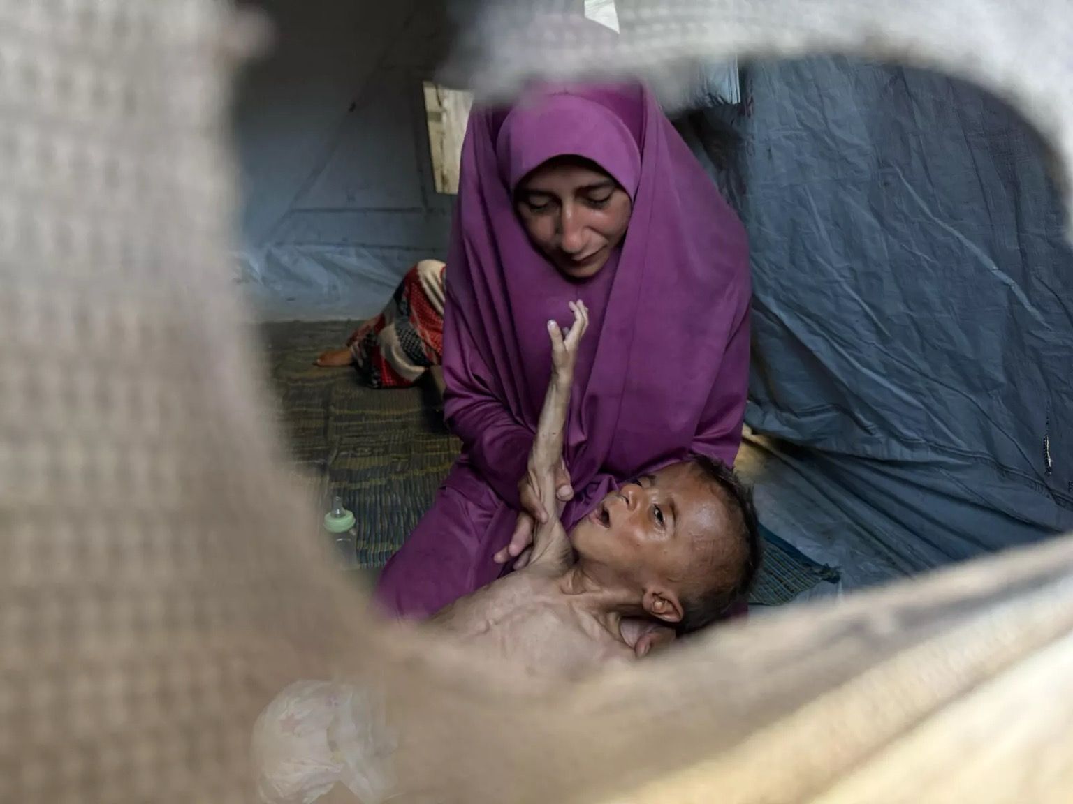 Photo by NPR. In the tent where they are living after being displaced by the war, baby Mohammad reaches up to his mother in the Gaza Strip. His five-year-old sister is faring better, but Mohammad's small body has been unable to withstand the hunger. Anas Baba/NPR. A mother in purple robes and headdress tries to soothe a visibly starving emaciated child in Gaza. 
