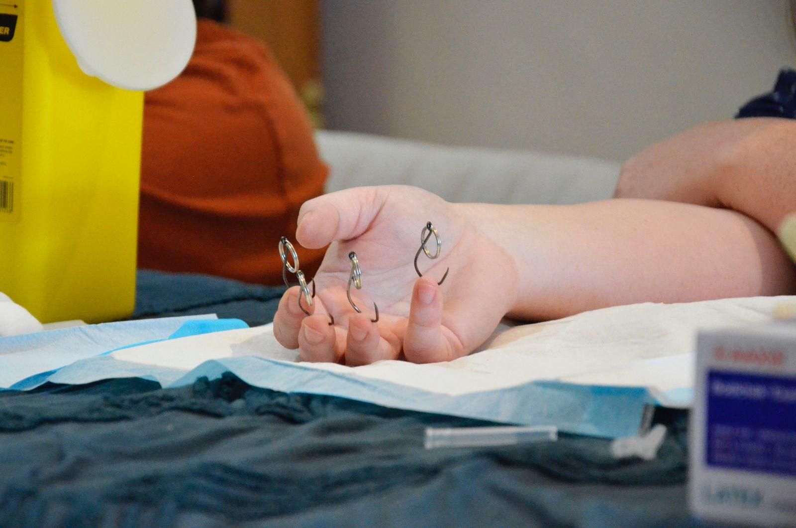 A hand rests palm up on a swab covered table. A single fish hook with attached ring has been pierced through each fingertip. Caps from the piercing needles are on the table along with a box of bandaids and a sharps container.