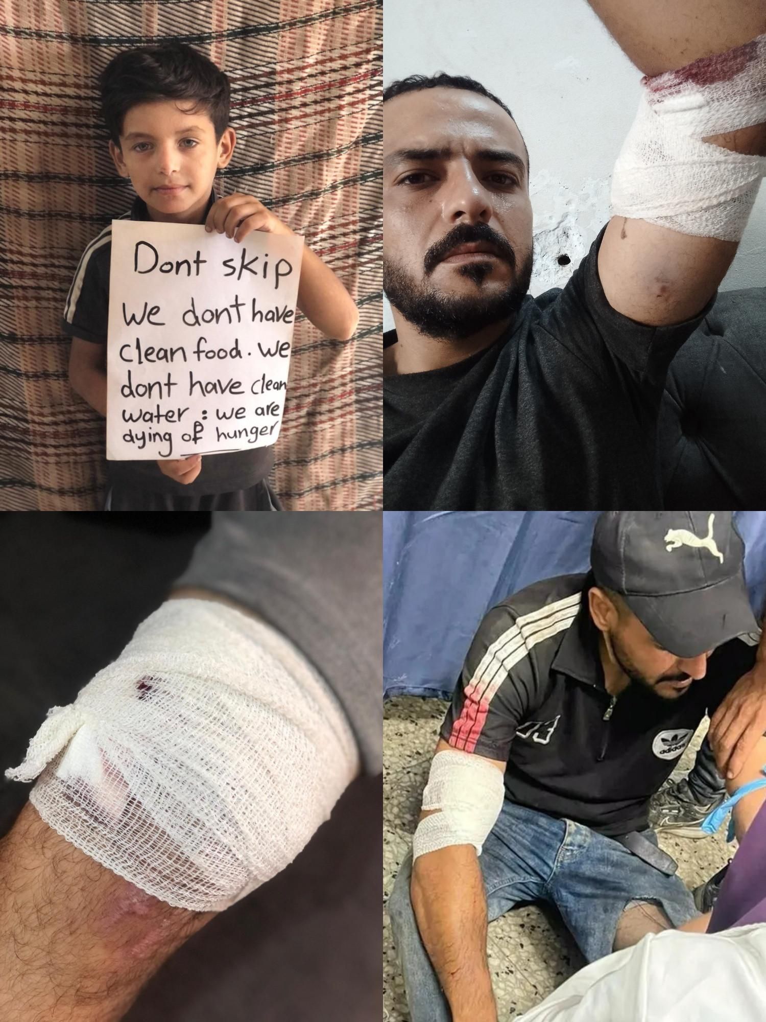 I’m Waseem from Gaza. I’m asking you from the heart—please don’t ignore this post. For more than 14 days, my family has received no support. We are in desperate need of food and medicine. I was wounded in the war, and this campaign is our last lifeline. Please help us stay alive. 🤍🙏
https://gofund.me/35fdca7d
